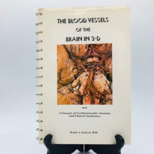 Rare Viewmaster Reels Circa 1973 Blood Vessels of the Brain in 3-D by Harry A. Kaplan